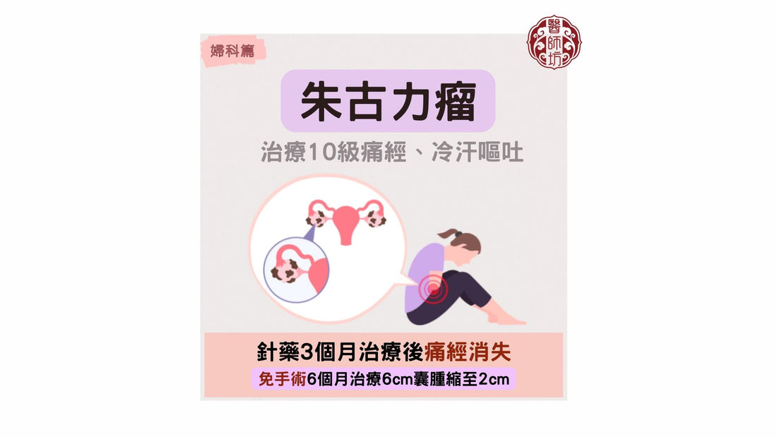 【朱古力瘤病案分享:治療10級痛經，伴冷汗嘔吐】 - 醫師坊中醫診所 EC.Fong Chinese Medicine Clinic 